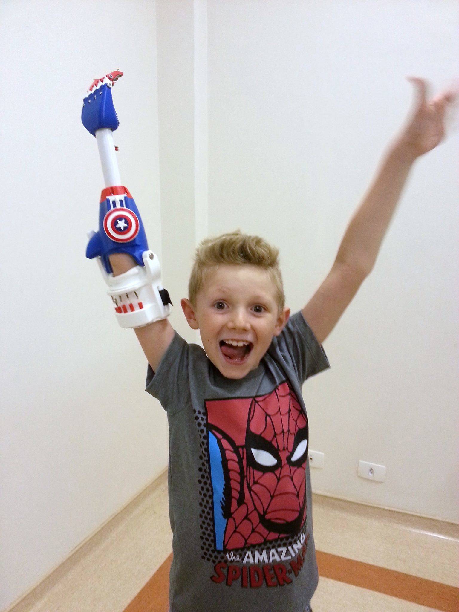 3D printed Prostethic arm - 3d рrіntеd