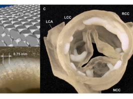 3D-printed aortic roots may help to predict paravalvular leak post-TAVR