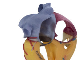 Glass Filled Materials